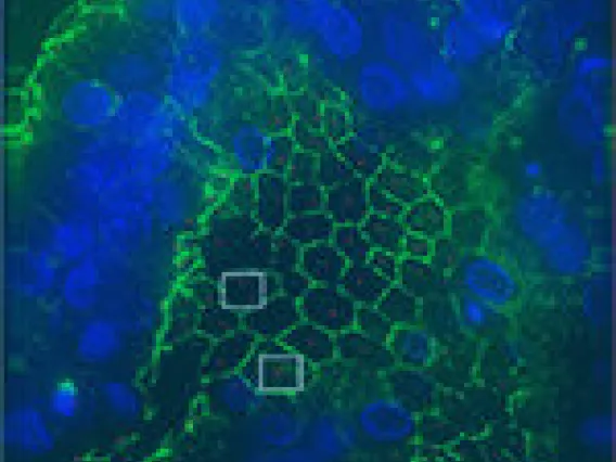 cancer biomarkers
